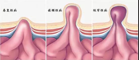 广东省医院治疗脑瘤的专业解析